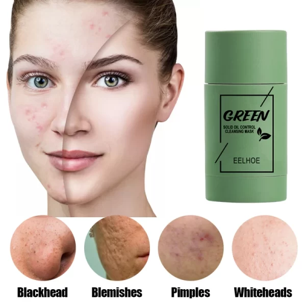 Charcoal Acne Treatment Face Mask - Image 5