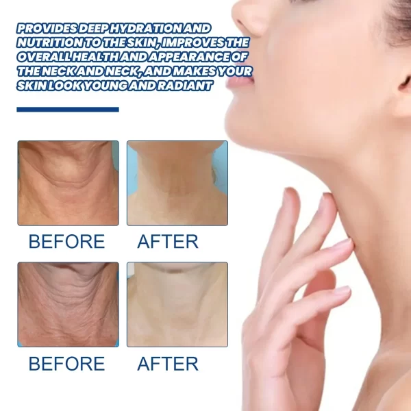 Anti-aging Neck Lines Protein Cream - Image 6