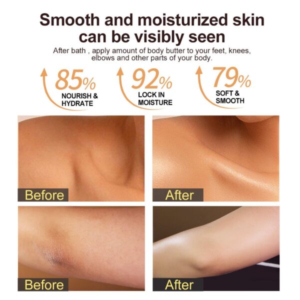 Shea Body Butter for Dry Skin - Image 5