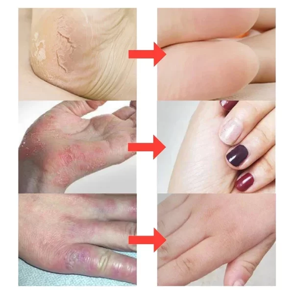 Clam Oil Cracked Repair Hand Cream - Image 3