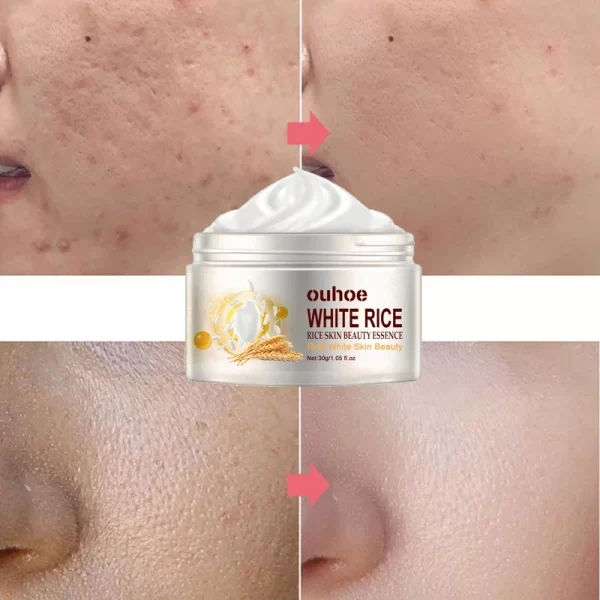 Rice Anti-wrinkle Facial Cream Acne Melasma Treatment Pigmentation Whitening Face Lifting Beauty Moisturizer Korean Cosmetics30g - Image 2