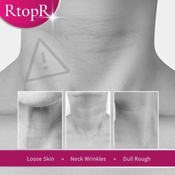 RtopR Neck Firming Wrinkle Remover Cream - Image 5