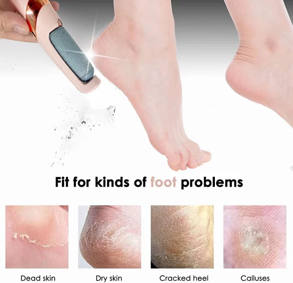 Electric Callus Remover for Feet, Rechargeable Foot File Pedicure Tool, Portable Foot Callus Remover Waterproof Profess,Pedicure - Image 6