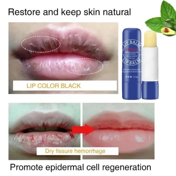 Remove Dark Lip Balm Lighten Melanin Lip Mask Exfoliating Fade Lip Line Dead Skin Moisturizing Brighten Repair Lip Care Product - Image 4