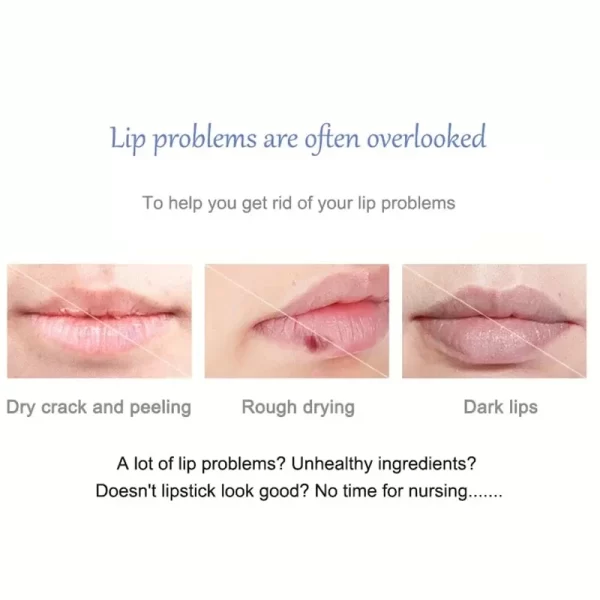 Remove Dark Lip Balm Lighten Melanin Lip Mask Exfoliating Fade Lip Line Dead Skin Moisturizing Brighten Repair Lip Care Product - Image 6