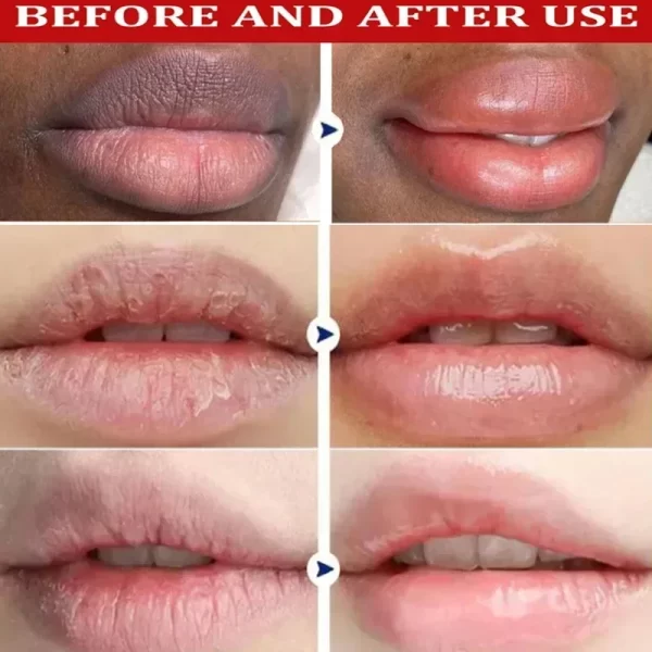 Remove Dark Lip Balm Lighten Melanin Lip Mask Exfoliating Fade Lip Line Dead Skin Moisturizing Brighten Repair Lip Care Product - Image 5